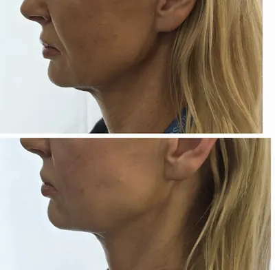 sigma clinica - medycyna estetyczna, regeneracyjna & anti-aging